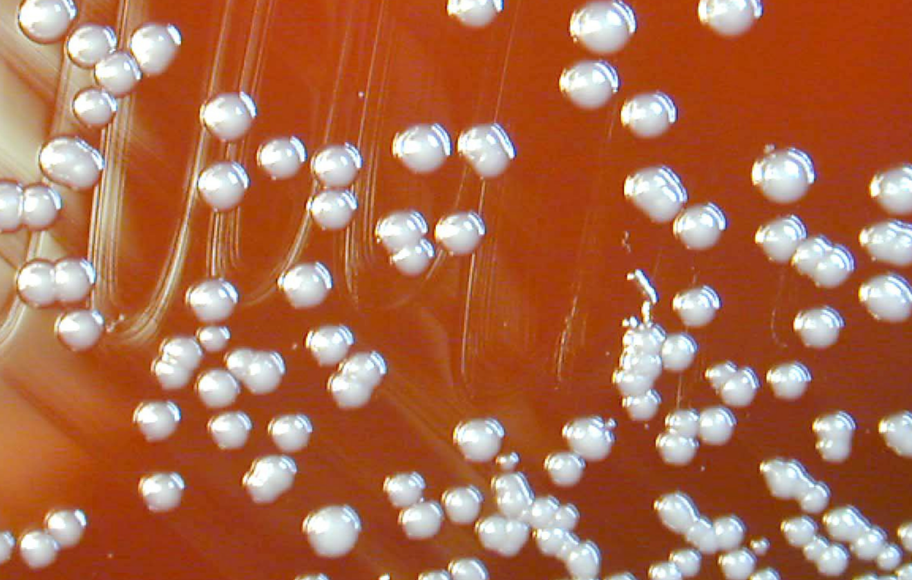 Burkholderia vietnamiensis