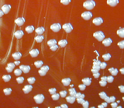 Burkholderia vietnamiensis