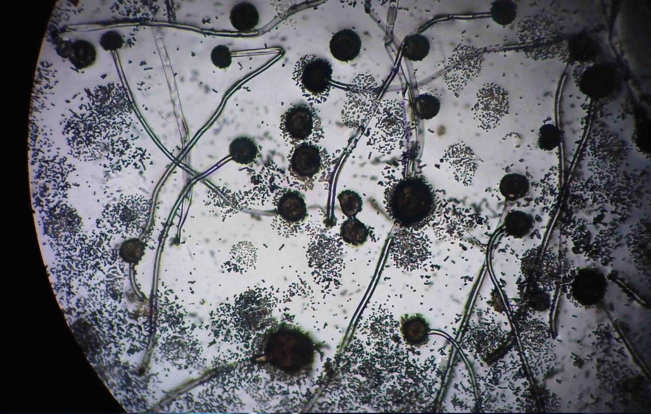 Gluconacetobacter diazotrophicus