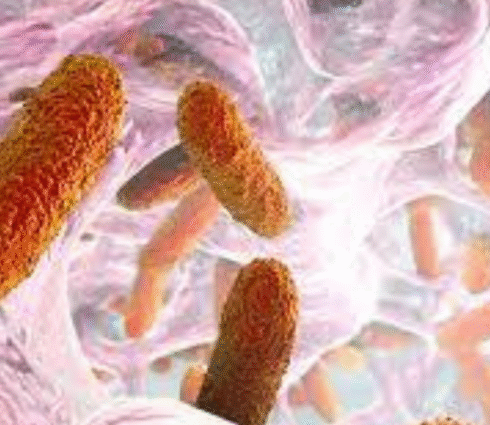 Klebsella pneumoniae