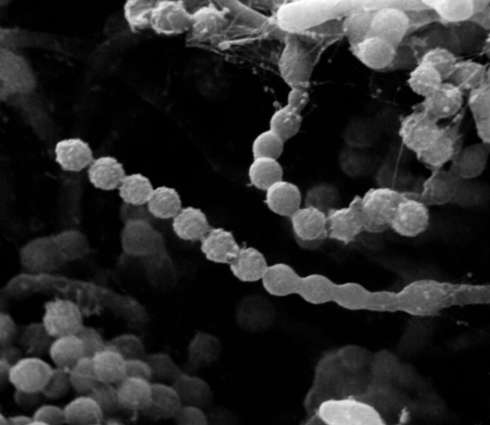 Paecilomyces lilacinus