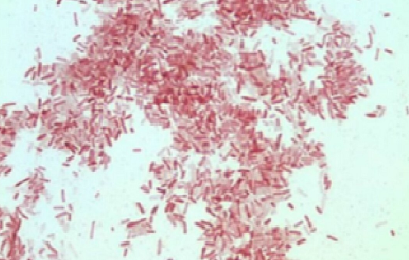 Photorhabdus luminescens