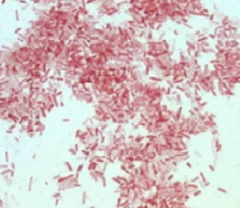 Photorhabdus luminescens