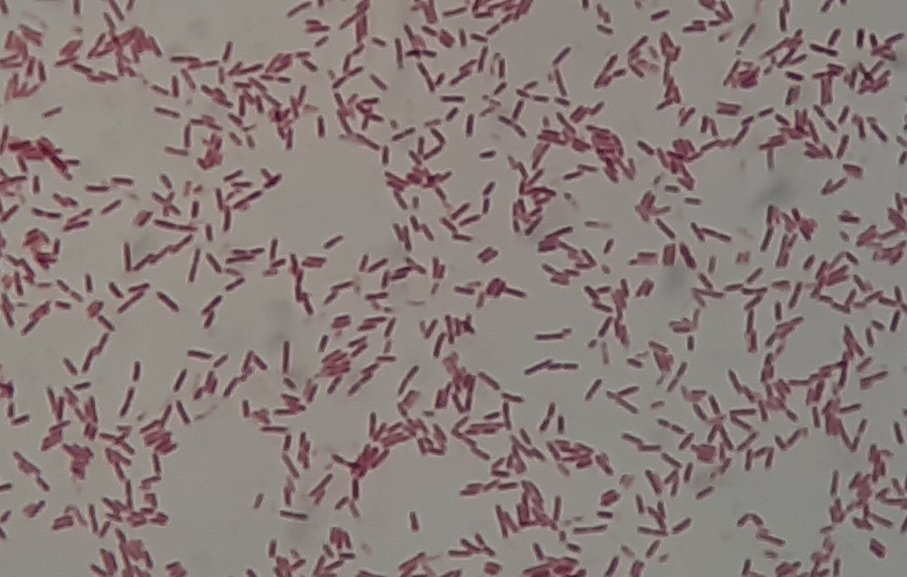 Serratia fonticola