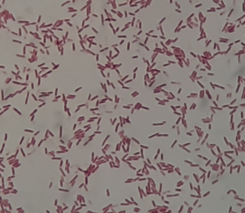 Serratia fonticola