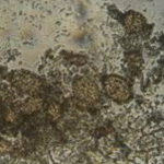 Ampelomyces quisqualis