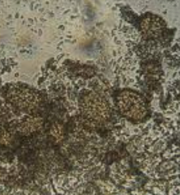 Ampelomyces quisqualis