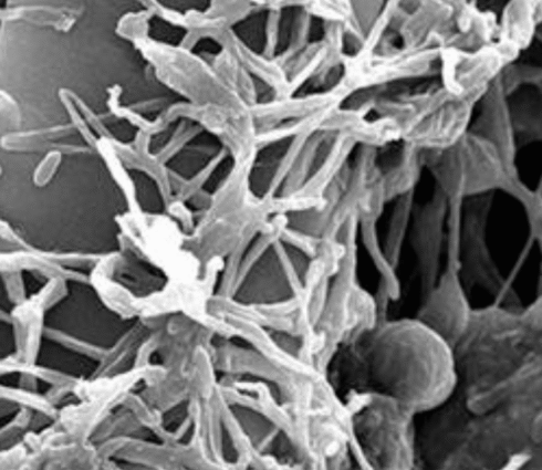 Lecanicillium longisporum