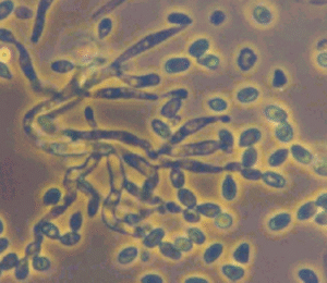 Metarhizium anisopliae
