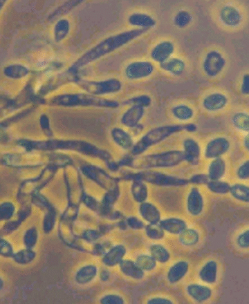 Metarhizium anisopliae