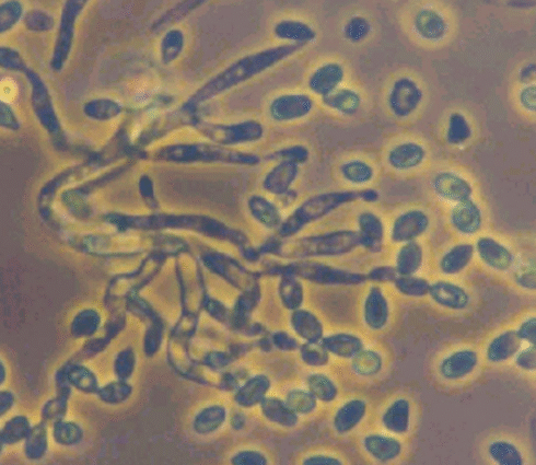 Metarhizium anisopliae
