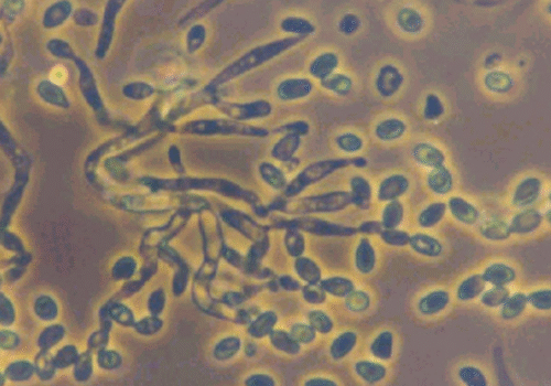 Metarhizium anisopliae
