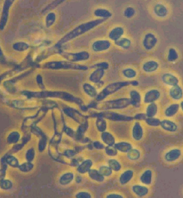 Metarhizium anisopliae